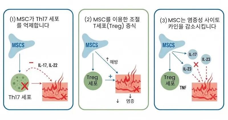 건선 줄기세포 치료에서의 세 가지 작용 메커니즘 (Th17 세포 억제, 조절 T 세포 증가, 염증성 사이토카인 감소) 도해