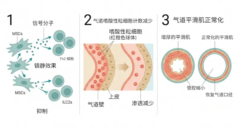 重症哮喘间充质干细胞治疗三大作用机制示意图:Th2/ILC2抑制、嗜酸性炎症减少、气道重塑减缓
